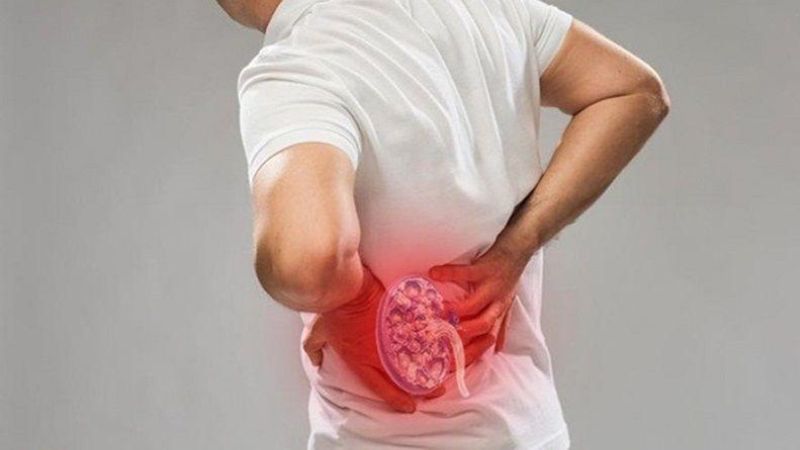 Thận ứ nước có thể dẫn đến áp xe thận
