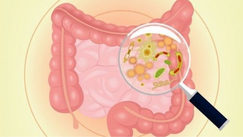 Viêm ruột có thể gây thiếu canxi Viêm ruột có thể gây thiếu canxi
