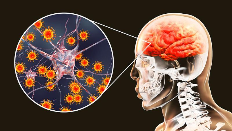 Viêm não Nhật Bản là bệnh tổn thương tế bào não do virus JE gây nên