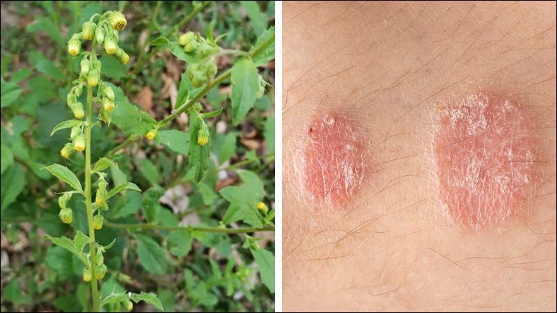 Cây cải trời thường được sử dụng trong các bài thuốc điều trị bệnh ngoài da