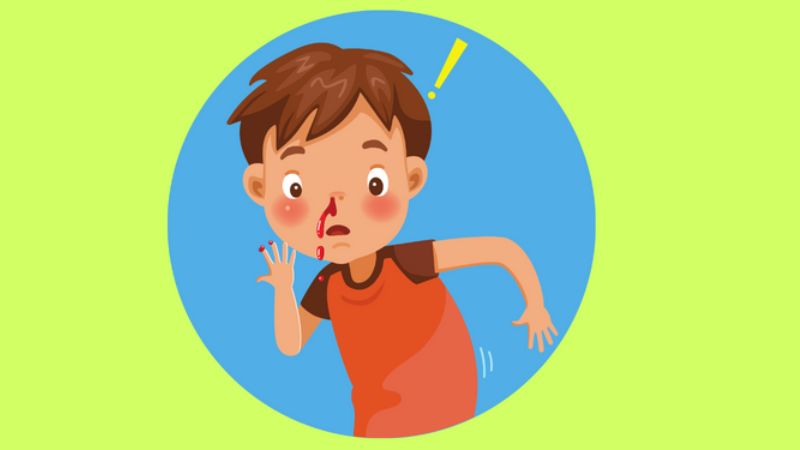 Chảy máu cam là tình trạng chảy máu từ mao mạch mũi