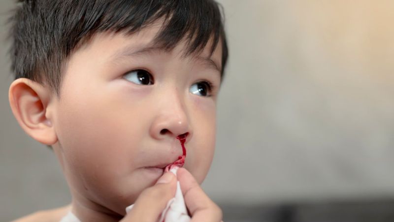 Chảy máu mũi đỏ tươi có thể là triệu chứng của bệnh
