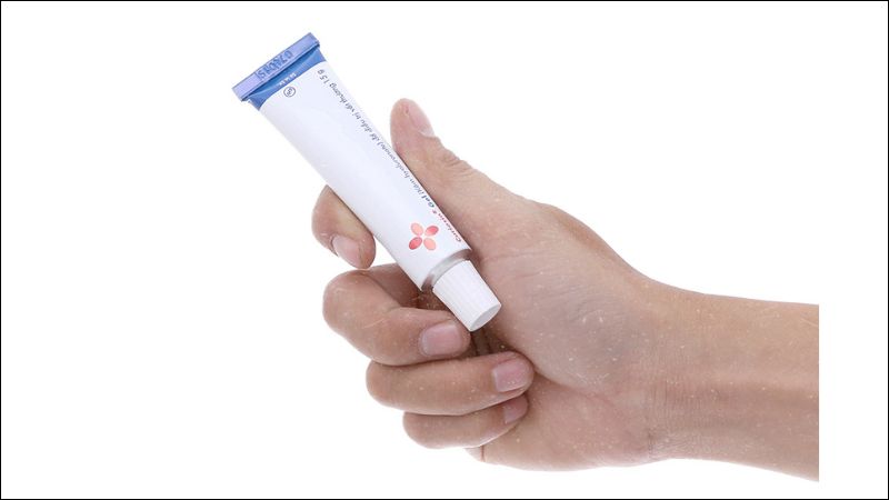 Trường hợp chống chỉ định khi sử dụng Curiosin Gel