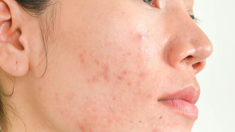 Bạn nên đến gặp bác sĩ để được thăm khám và tư vấn khi da có dấu hiệu bất thường 
