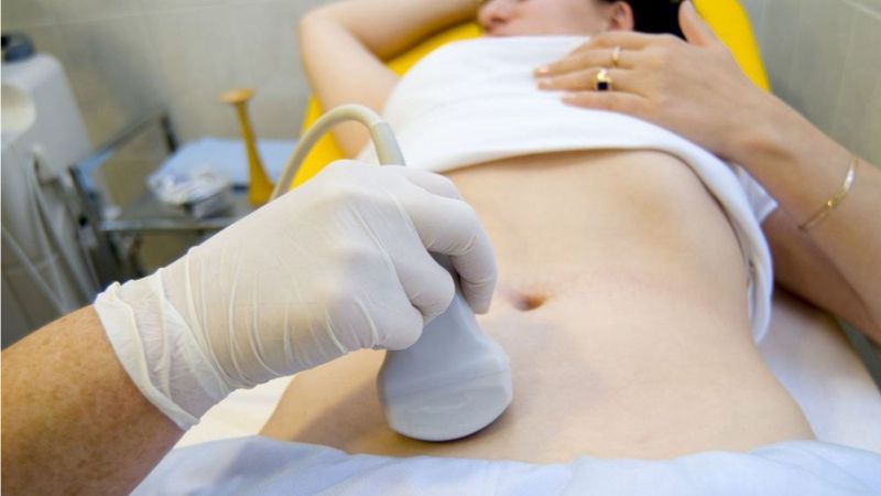 Siêu âm là biện pháp giúp phát hiện nguyên nhân đau bụng quanh rốn Siêu âm là biện pháp giúp phát hiện nguyên nhân đau bụng quanh rốn