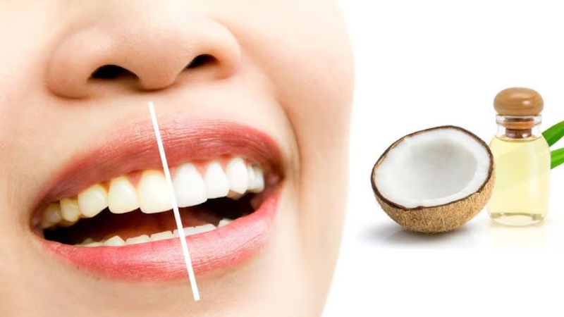 Dầu dừa có tác dụng làm sạch các mảng bám và loại bỏ dần các vết ố vàng trên bề mặt men răng Dầu dừa có tác dụng làm sạch các mảng bám và loại bỏ dần các vết ố vàng trên bề mặt men răng