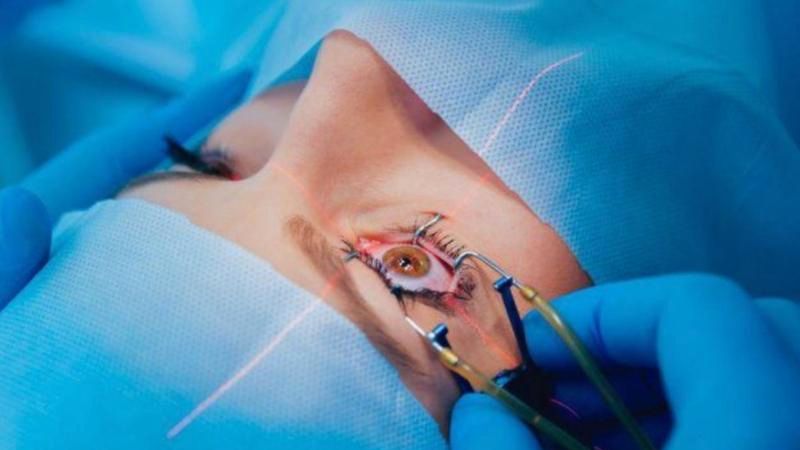 Hiện nay, loạn thị có thể được chữa khỏi với phẫu thuật bằng tia laser