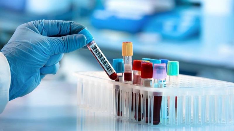 Xét nghiệm máu có thể giúp bác sĩ chẩn đoán mức độ và giai đoạn ngộ độc