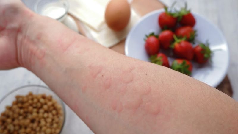 Ngứa họng có thể xảy ra khi dị ứng thức ăn