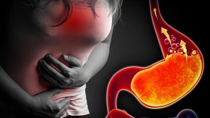 Trào ngực dạ dày thực quản có thể gây ngứa họng kéo dài