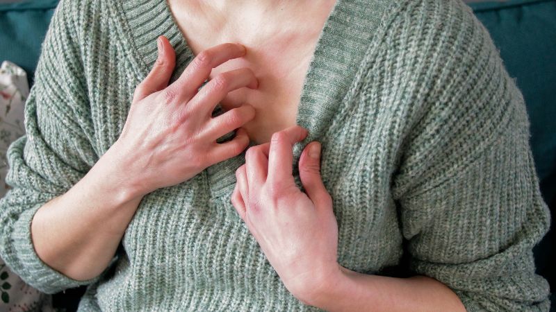 Các bệnh toàn thân có thể gây mẩn ngứa khắp người