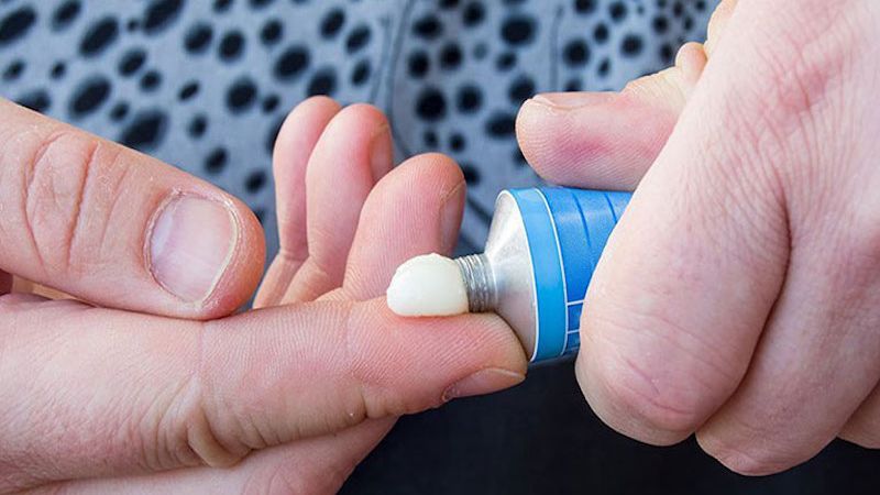 Các loại thuốc bôi có thể giúp điều trị mẩn ngứa