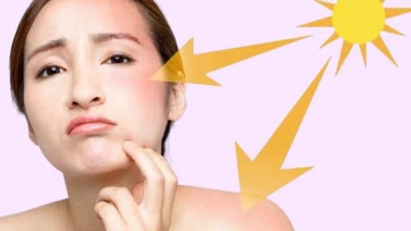Tác động của tia UV trong ánh sáng mặt trời cũng có thể gây sạm da