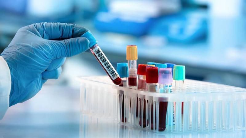 Xét nghiệm máu là phương pháp giúp chẩn đoán suy thận