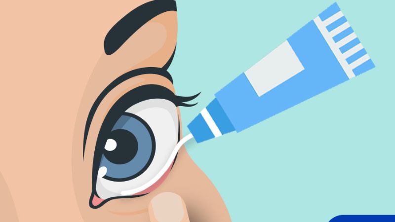 Nếu gặp dấu hiệu bất thường nào sau khi dùng thuốc mỡ tra mắt, hãy liên hệ ngay với bác sĩ hoặc dược sĩ