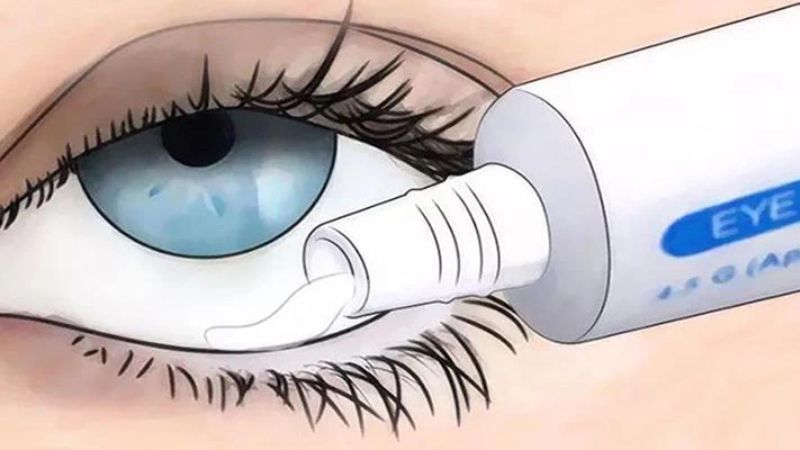 Tác dụng phụ thường gặp như cay mắt và mờ mắt sẽ tự khỏi sau một thời gian ngắn