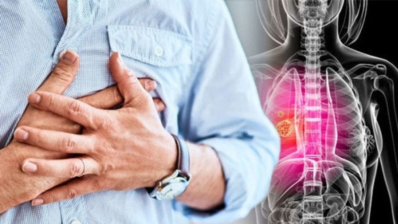 Đau tức ngực có thể là triệu chứng của ung thư phổi di căn hạch