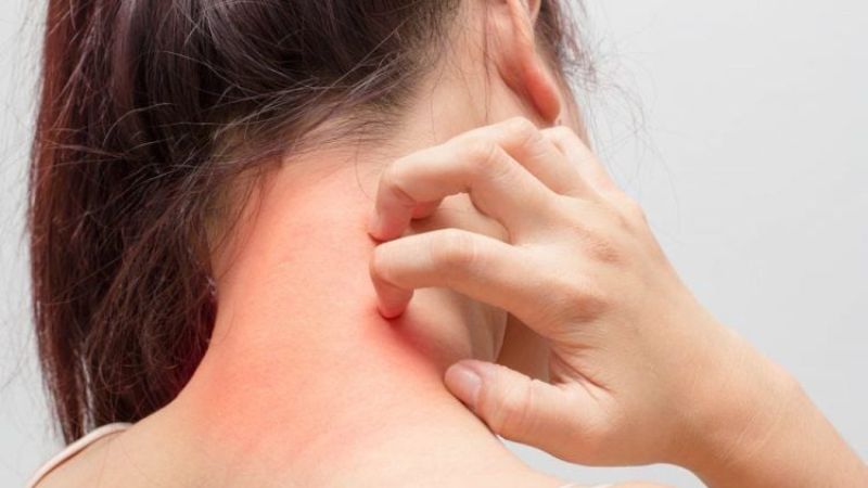 Bạn không nên dùng lòng đỏ trứng gà ngâm mật ong nếu có tiền sử dị ứng