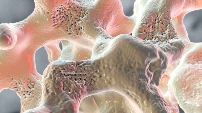 Thiếu vitamin D có thể dẫn tới loãng xương
