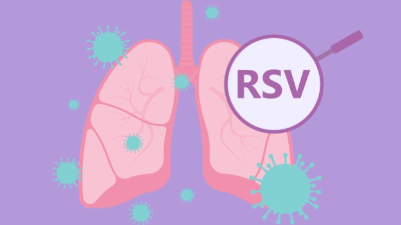 Virus hợp bào hô hấp RSV có thể là nguyên nhân gây ra viêm phổi do virus