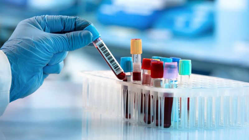 Xét nghiệm máu giúp đánh giá khả năng đáp ứng của hệ miễn dịch với vi khuẩn lao 