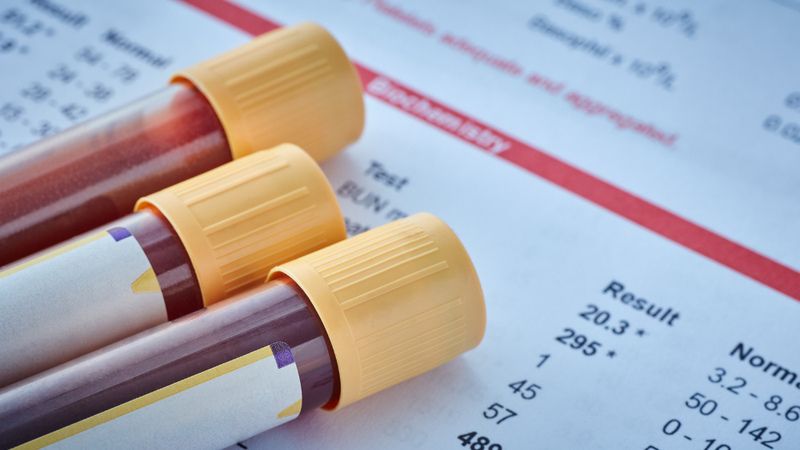 Xét nghiệm công thức máu có thể đánh giá được số lượng tế bào trong máu ngoại vi