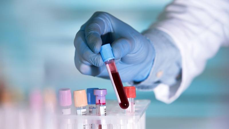 Xét nghiệm máu thường phát hiện virus HPV chỉ sau khoảng 15 – 30 phút