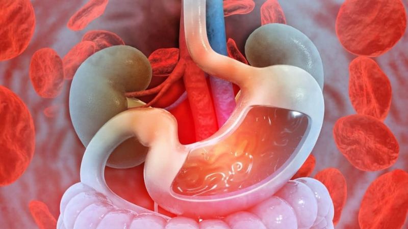 Xuất huyết tiêu hóa là tình trạng máu chảy ra từ bất kỳ phần nào của ống tiêu hóa