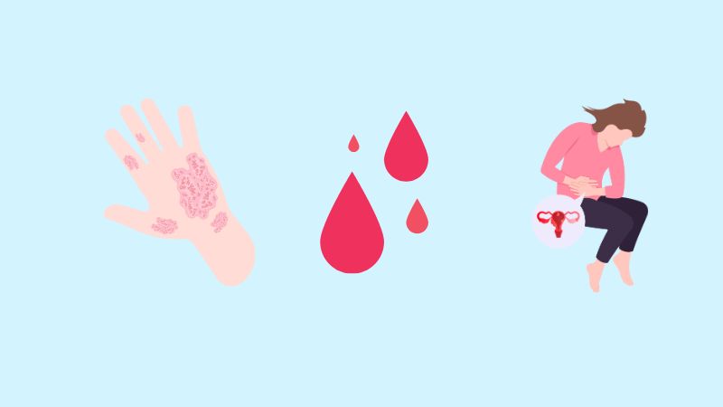 Tuy thủ thuật LEEP an toàn nhưng vẫn tiềm ẩn một số rủi ro như nhiễm trùng Tuy thủ thuật LEEP an toàn nhưng vẫn tiềm ẩn một số rủi ro như nhiễm trùng