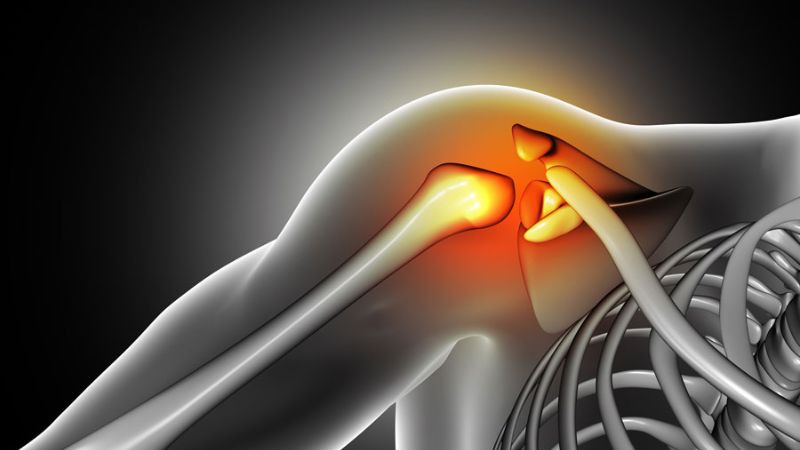 Chấn thương vai là một trong những nguyên nhân gây đau vai Chấn thương vai là một trong những nguyên nhân gây đau vai