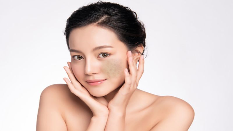 Hoạt chất từ nghệ tây giúp làm giảm melanin