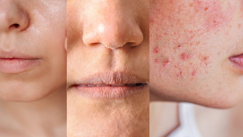 Tùy vào từng loại da mà tần suất và thời gian xông mặt sẽ khác nhau Tùy vào từng loại da mà tần suất và thời gian xông mặt sẽ khác nhau
