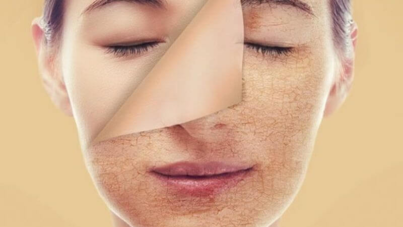 Uống nước buổi sáng giúp thanh lọc độc tố, làm mờ vết thâm sạm và trẻ hóa làn da