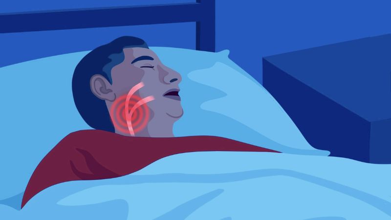 Hội chứng ngưng thở khi ngủ là nguyên nhân gây ra đổ mồ hôi đêm Hội chứng ngưng thở khi ngủ là nguyên nhân gây ra đổ mồ hôi đêm