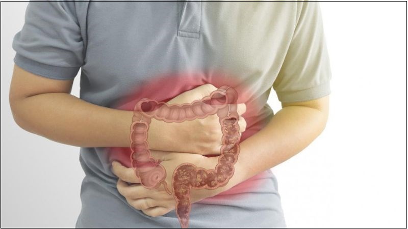Cần gặp ngay bác sĩ khi có những dấu hiệu của viêm đại tràng