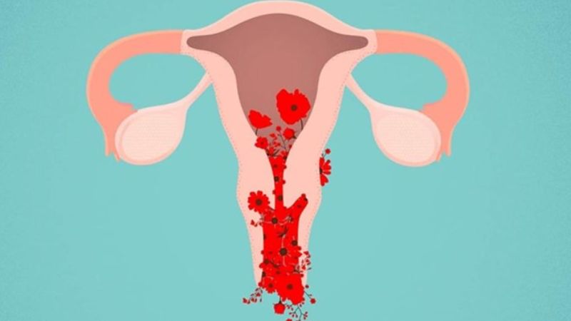 Phụ nữ rong kinh là một đối tượng nên bổ sung sắt