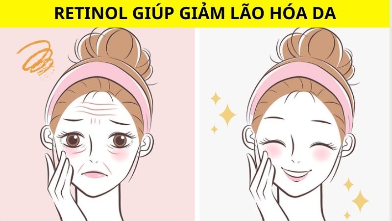 Retinol hỗ trợ ngăn ngừa lão hóa da