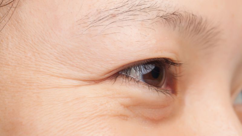 Retinol hỗ trợ làm giảm nếp nhăn