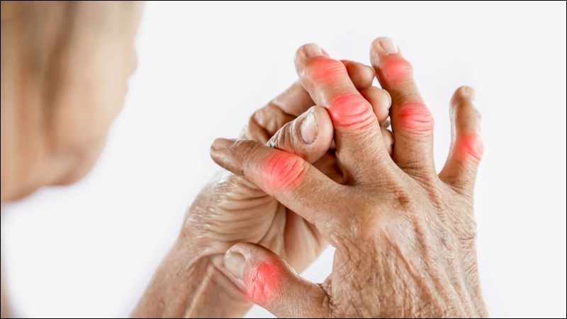 Histidine có khả năng hỗ trợ điều trị viêm khớp dạng thấp