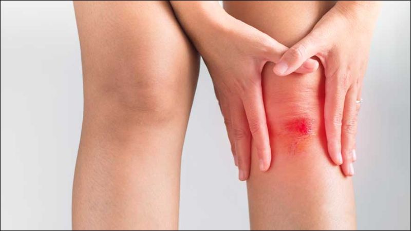 Mangan giúp chữa lành vết thương bằng cách tăng sinh collagen