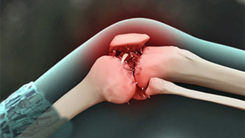 Mangan góp phần làm giảm tình trạng viêm và đau, đặc biệt trong bệnh viêm xương khớp