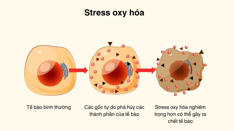 Stress oxy hóa là sự mất cân bằng giữa các gốc tự do và chất chống oxy hóa trong cơ thể