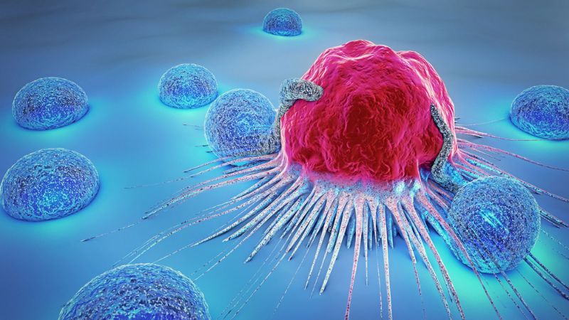 Whey protein có thể hỗ trợ điều trị ung thư 