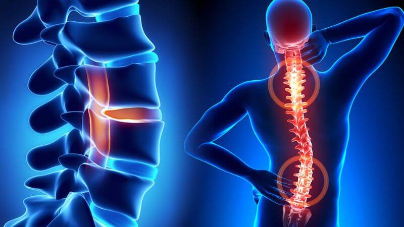 Có nhiều phương pháp khác để điều trị viêm khớp Có nhiều phương pháp khác để điều trị viêm khớp
