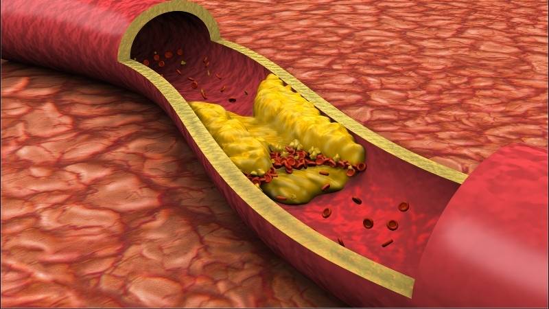 Chiết xuất quả tầm xu&acirc;n gi&uacute;p giảm mức cholesterol trong m&aacute;u