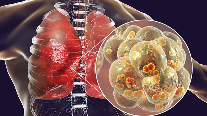 Bản lam căn có mặt trong bài thuốc chữa viêm phổi