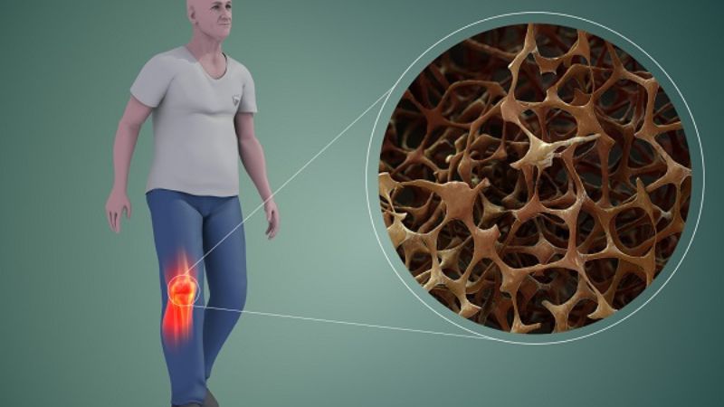 Kali giúp ngăn ngừa loãng xương nhờ làm giảm lượng canxi mất đi qua nước tiểu