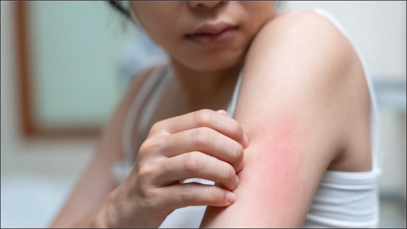 Menthol thường được sử dụng để giảm cảm giác ngứa trên da