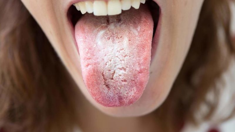 Cỏ mần trầu được sử dụng trong bài thuốc chữa tưa lưỡi