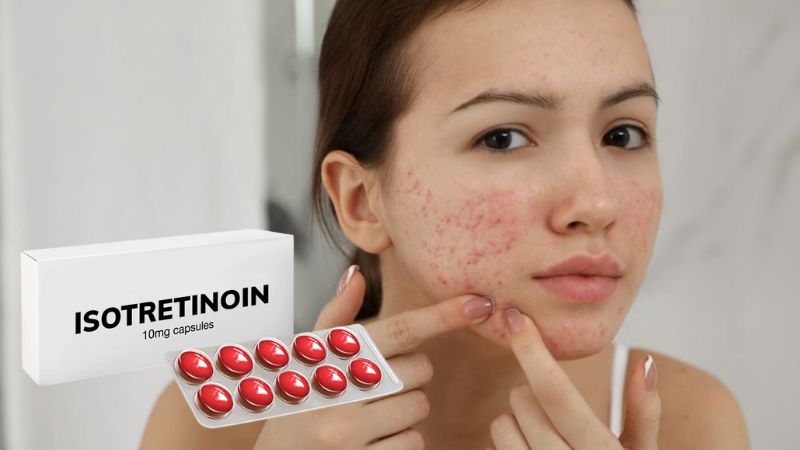 Isotretinoin được dùng để điều trị mụn trứng cá ở mức vừa và nặng, không đáp ứng với các phương pháp điều trị khác